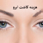 هزینه کاشت ابرو